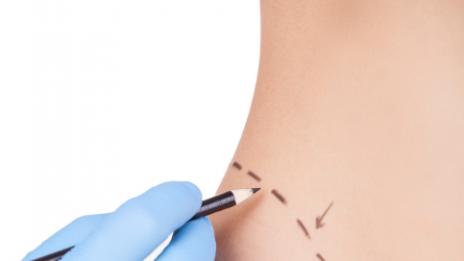 Помислете пак, преди да легнете под ножа