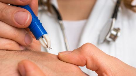 Специалист: Не вадете кърлежа сами