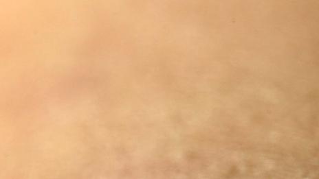 Защо комарите хапят повече жени