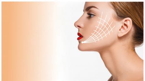 За по-младо лице: Радиочестотен лифтинг