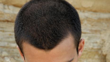 Овча плацента спасява мъжете от изчервяване