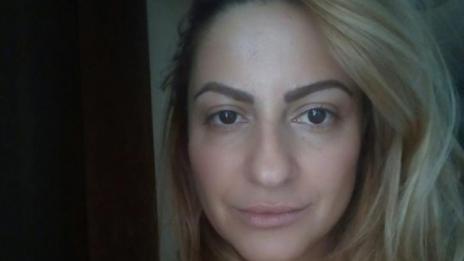 Нели от „Търси се “ пострада при разкрасителна процедура