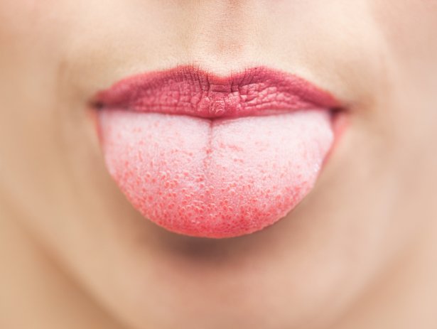 Снимка: Istock