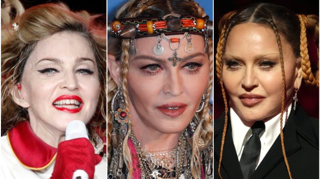 Лицето на Мадона – с ринопластика, филъри и ботокс