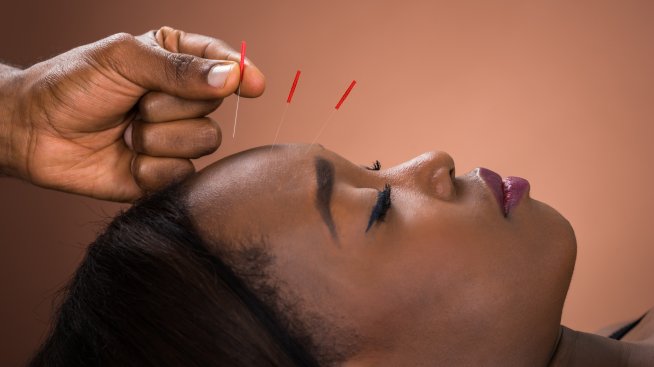 Лицева акупунктура – новият стар метод за подмладяване