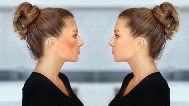 4 доказани начина за справяне с хиперпигментацията 