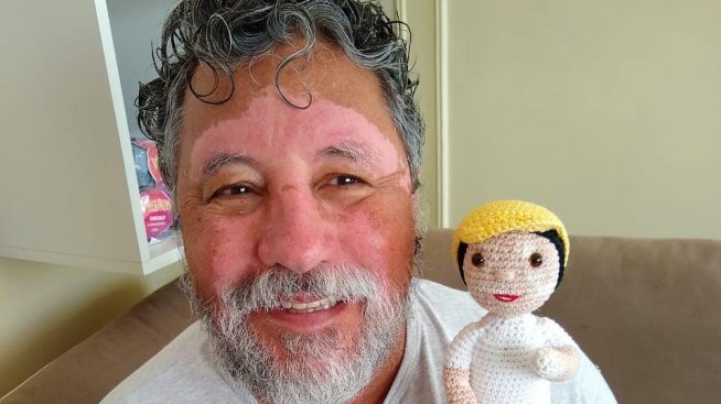 В помощ на децата с витилиго