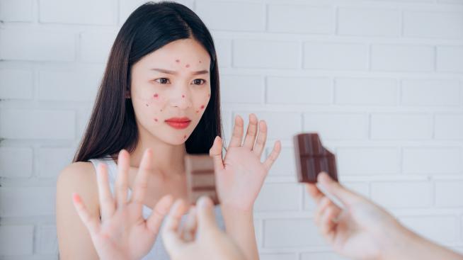 Проблемна кожа – кои храни и напитки да избягвате?