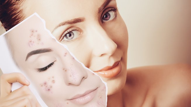 Грижа за кожата – 6 причини за беленето и лющенето