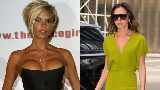 Виктория Бекъм разкри защо е премахнала силикона в гърдите си