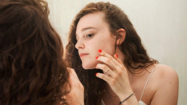 Хормонално vs бактериално акне – от какво страдате и как да го лекувате?