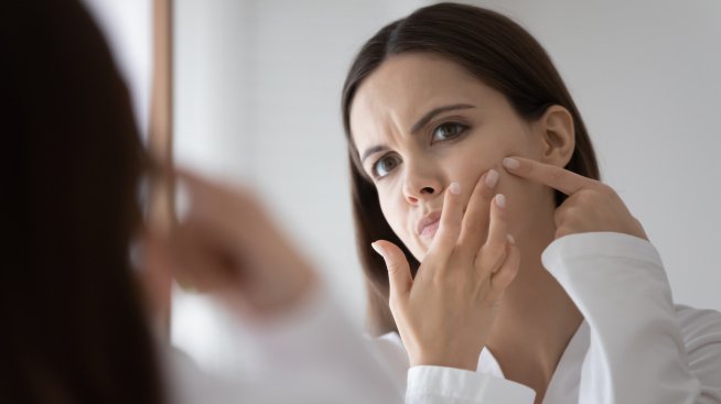 Черни точки – как да ги премахнем, без да нараним кожата?