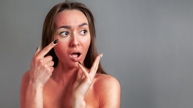 Слънчево изгаряне - как да се отървем от него по най-бързия начин