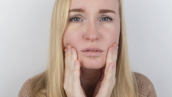 Защо устните ви се цепят в краищата и какво можете да направите за това