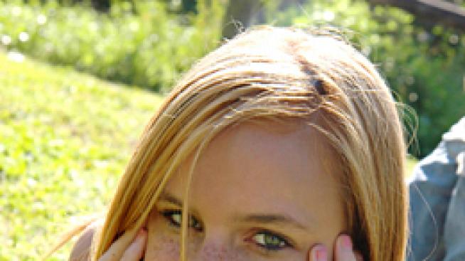 Перфектна млада кожа - без акне и петна