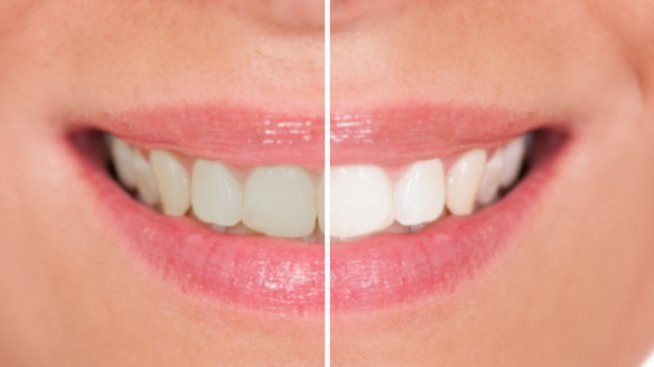 5 домашни трика за по-бели зъби