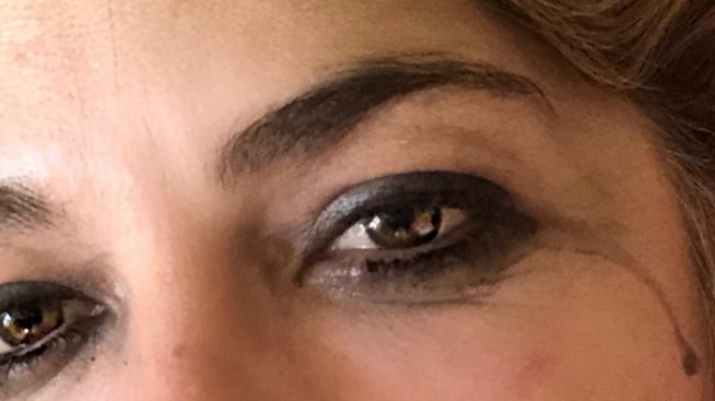 Селма Блеър с емоционален пост за болестта й