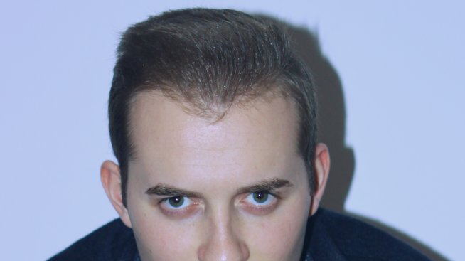 Как да спре разделянето и овладяването на човешкото общество?