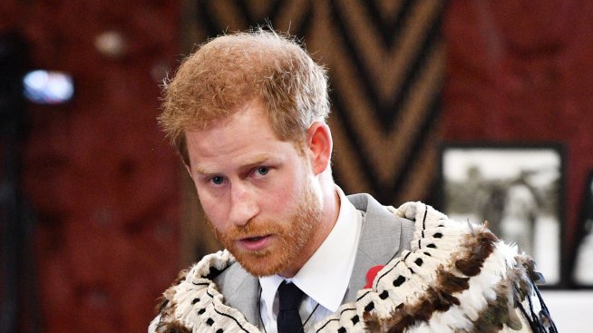 Експерт: Принц Хари ще оплешивее до 50