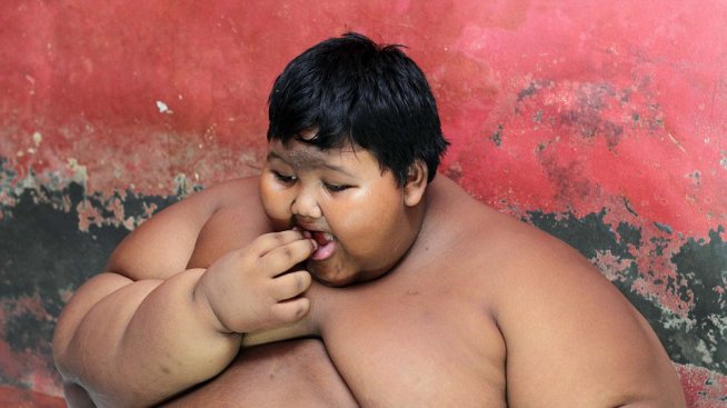 Най-дебелото дете: Едва на 10 години, а тежи 192 кг