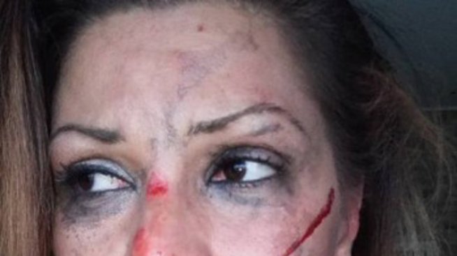 Имало ли е побой над Сани Алекса? Говори гаджето ѝ