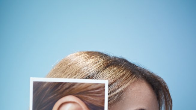 Рисковете при отопластика