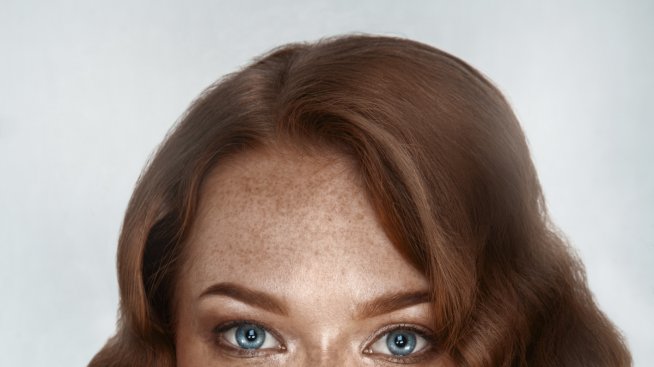 Какво не знаем за луничките?