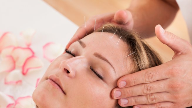 За млада и сияйна кожа: Акупунктура на лицето