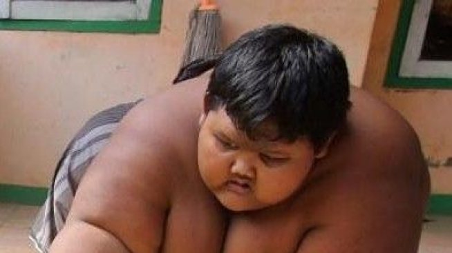 Най-дебелото момче в света топи килограми