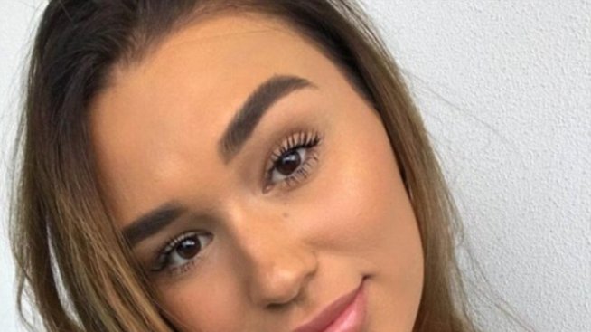 3 стъпки, с които ще прикриете акнето за нула време