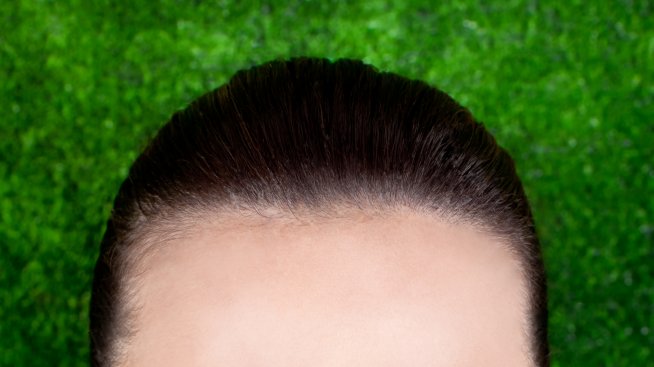 Нова техника може да промени цвета на очите