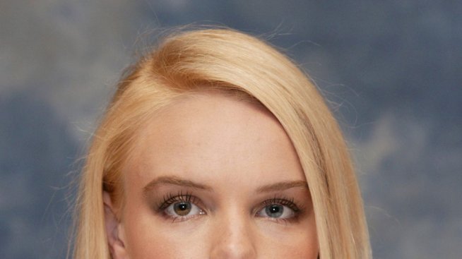 Недостатъци на звездите, които те превърнаха във визитна картичка