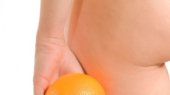 И ето защо целулитът ни мъчи години наред