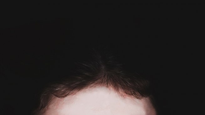 Как най-ефективно да се справим с бръчките?