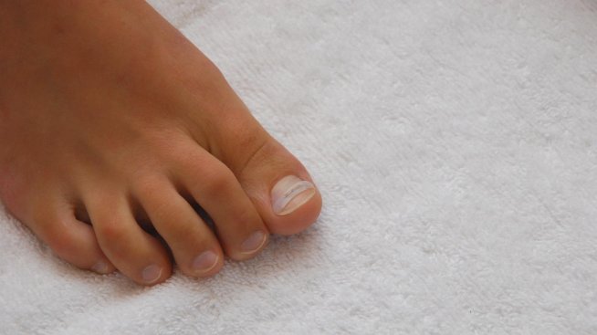 Впитите нокти – проблем, който има и безболезнено решение