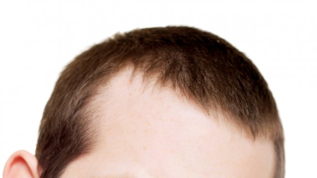 Срамно ли е мъжете да спазват диета