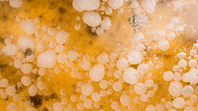 Нещата, които не знаете за мазнините в тялото си