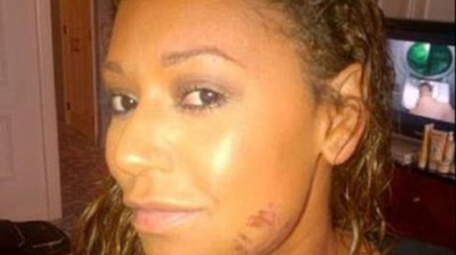 Мел Би с ужасяващи разкрития за брака си: Съпругът ѝ я душил, влачил