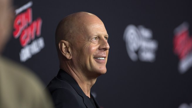 Плешивостта е секси