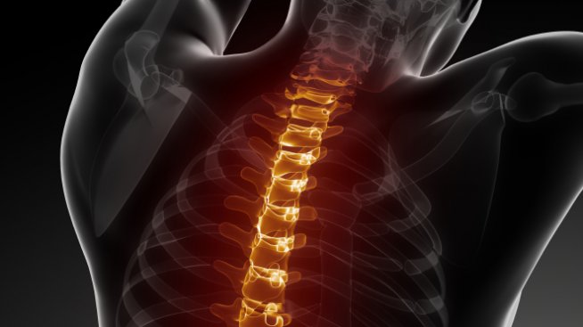 За гръбначните изкривявания и борбата с тях