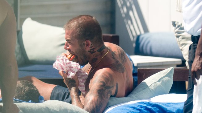 Бекъм си е трансплантирал коса?