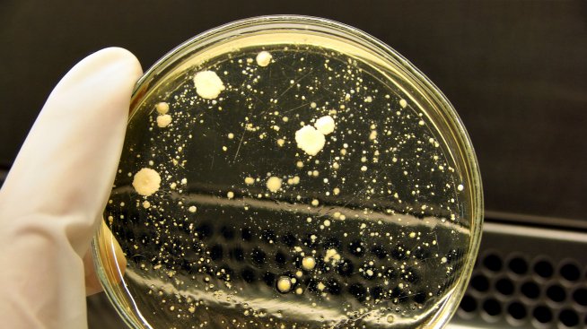 Връзката между гъбичните инфекции и начина ни на хранене