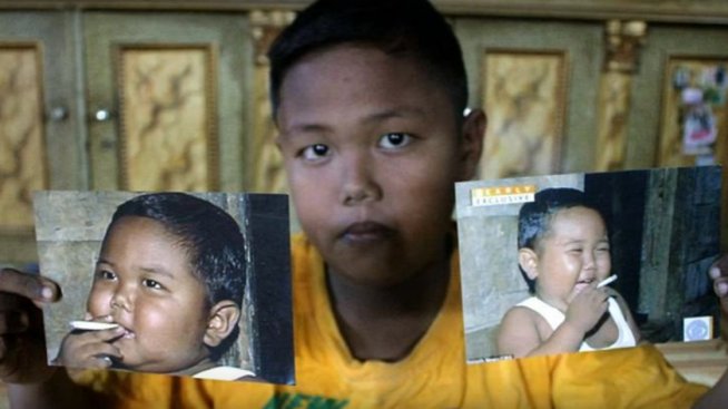 Как изглежда днес: Детето, което пушеше по 40 цигари дневно