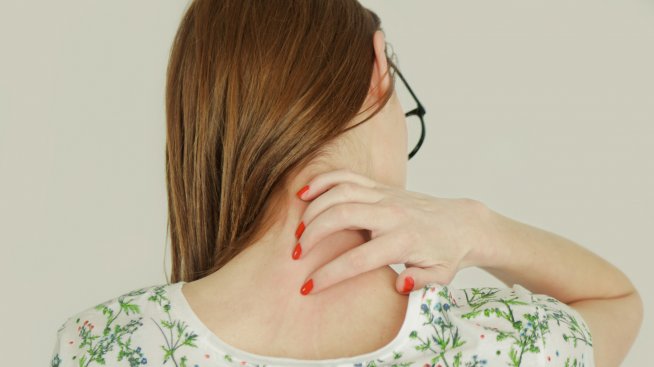 Ухапване от насекоми - за какво да внимавате?