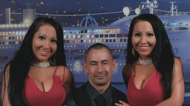 Близначките с общ мъж и пластични операции си искат старата външност