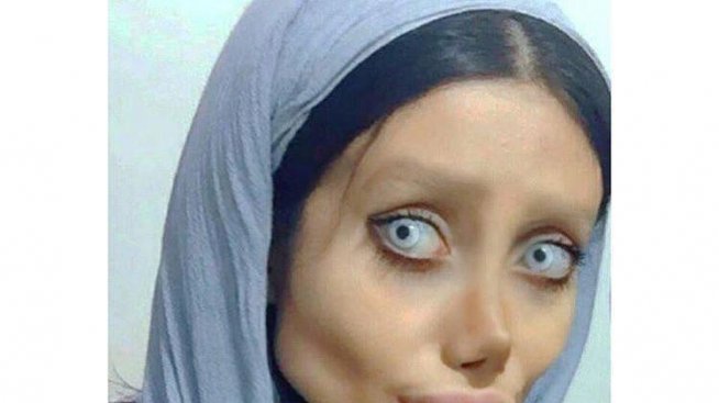 Да се превърнеш в зомби от желание да си копие на Джоли