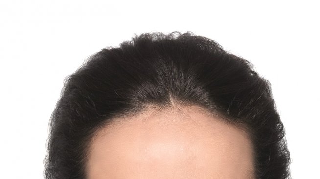 Как V-ефектът ни подмладява?