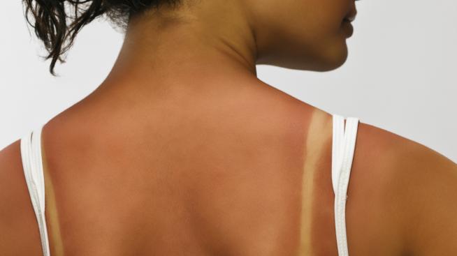 Как да премахнем разликата в тена?