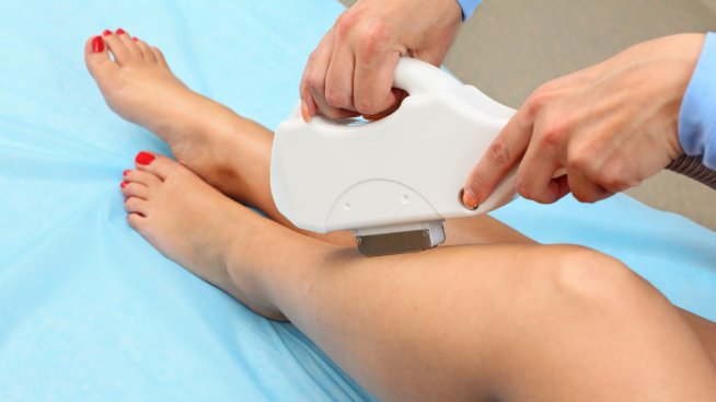 Съвети за лазерната епилация