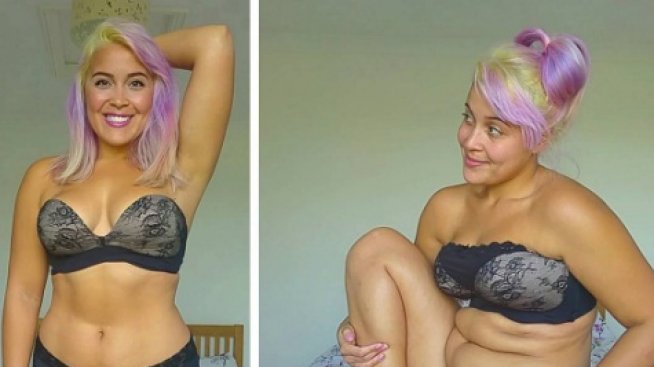 Британка се излекува от анорексия и показа наднорменото си тегло